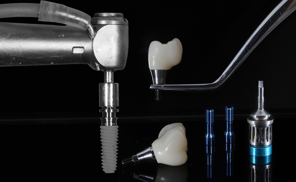 Signs It Is Time To Replace A Dental Implant Restoration