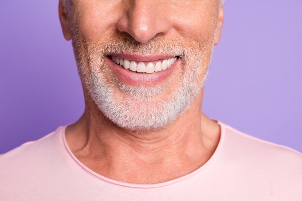 Signs That It Is Time To Replace Your Dental Veneers