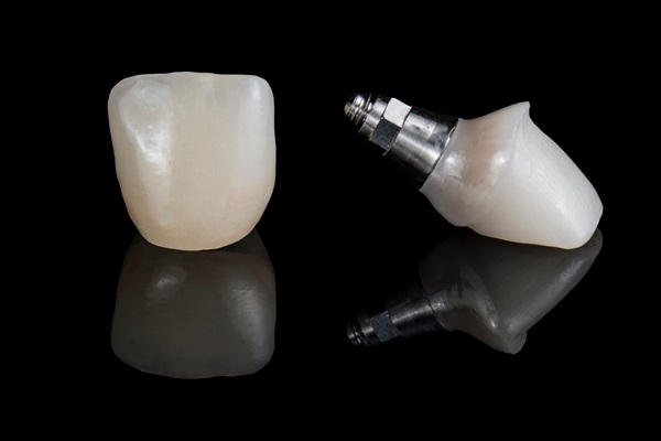 What Materials Are Used To Make An Implant Crown?