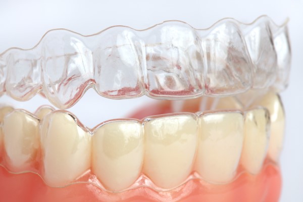 The Effects Of Smoking During Invisalign Treatment
